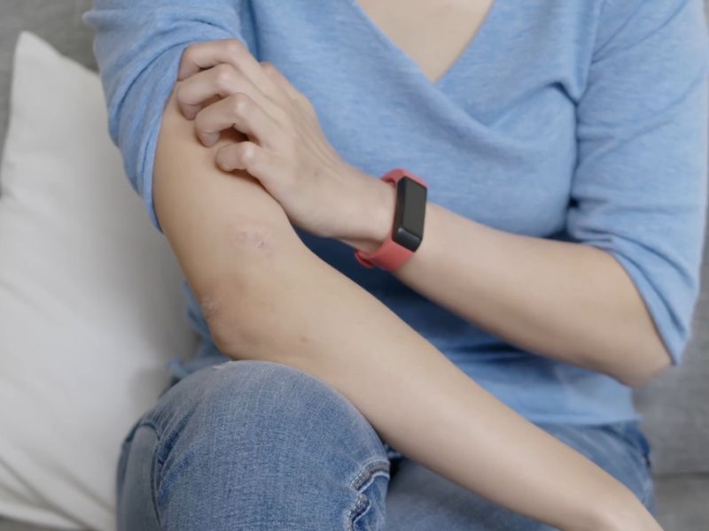 devojka koja pati od suve kože češe svoju ruku