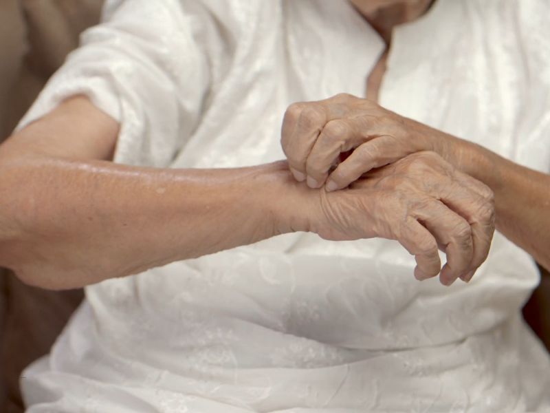 starija žena češe svoju ruku